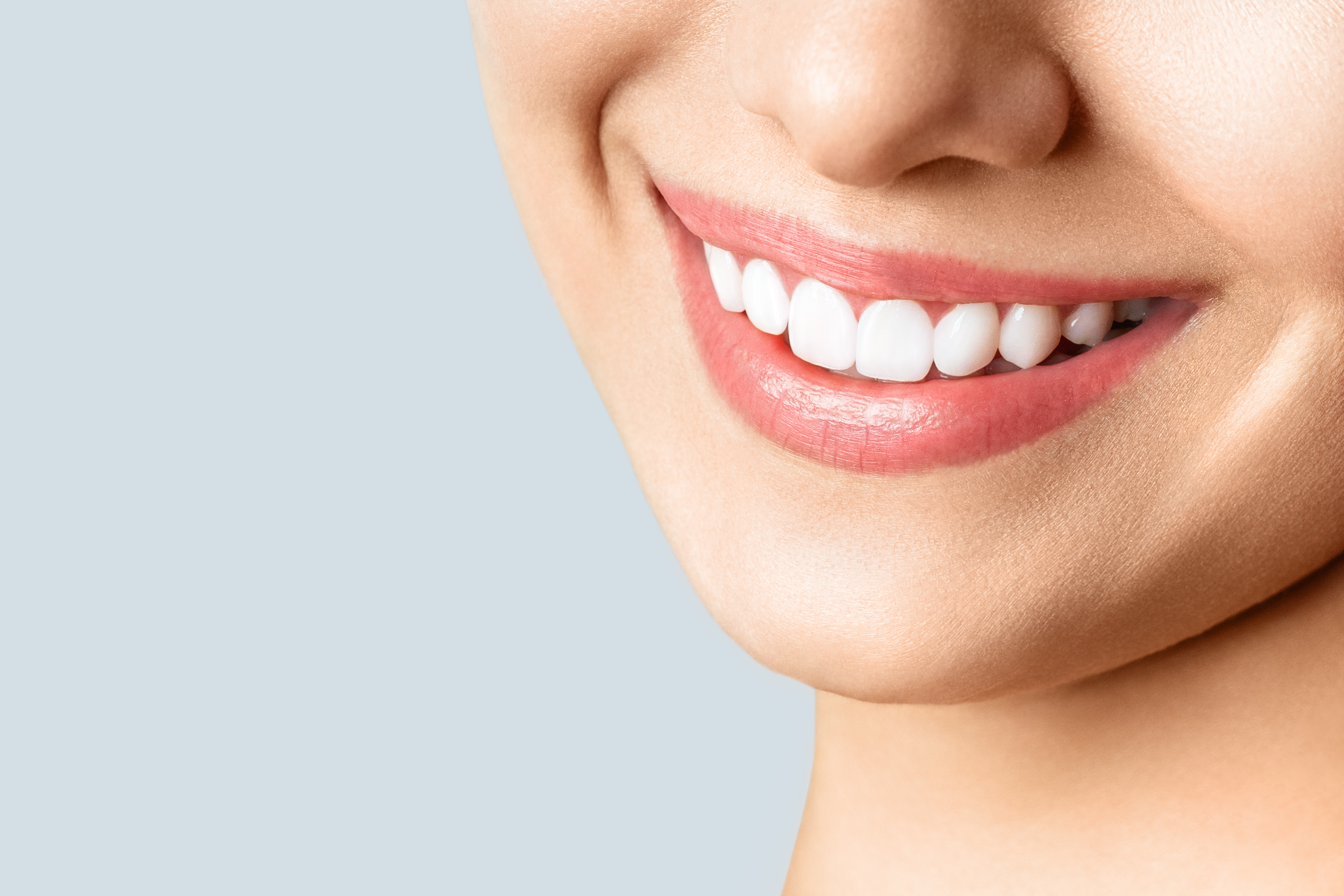 Veneer (Dental Veneer)